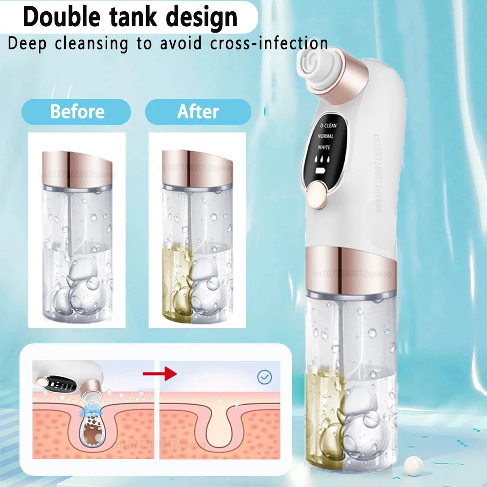 Electric Vacuum Blackhead Remover