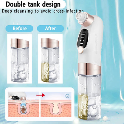 Electric Vacuum Blackhead Remover